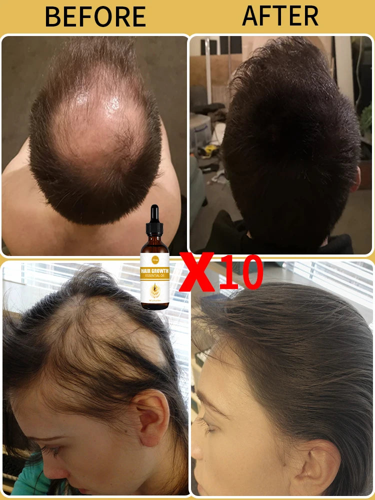 Fast Hair Growth Oil For men treatment
