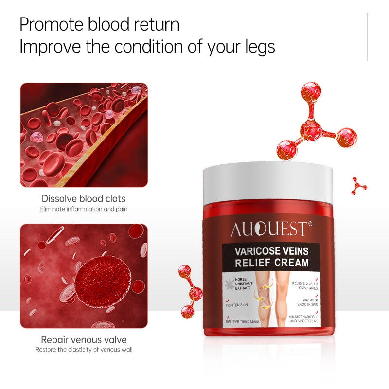 AUQUEST Varicose Veins Relief Cream Vasculitis Phlebitis Spider Pain Relief Ointment Medical Plaster Body Care 80g