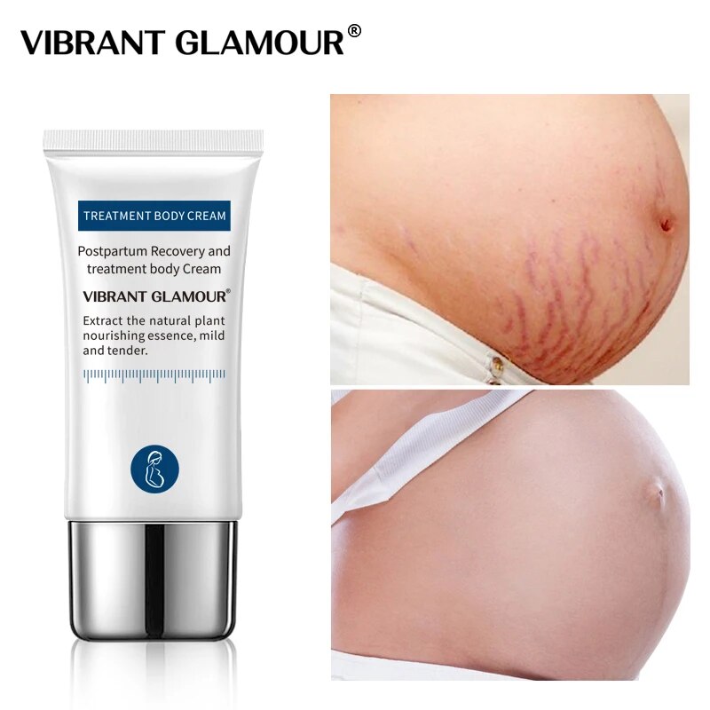 VIBRANT GLAMOUR Stretch marks remover Body Repair cream set Pregnancy Scars Obesity lines scar Anti Aging Firming Skin Care 2pcs