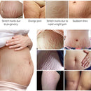 VIBRANT GLAMOUR Stretch marks remover Body Repair cream set Pregnancy Scars Obesity lines scar Anti Aging Firming Skin Care 2pcs