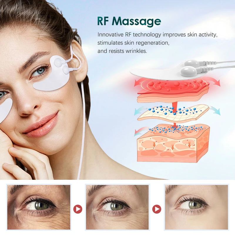 Microcurrent RF Massage Eye Mask Hydrogel Eye Patches Hot Massage EMS Eye Massage Device Reduce Wrinkles Puffiness Dark Circles