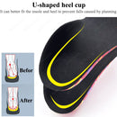 WINRUOCEN Insoles Orthoped Children Flat Foot Leg Health Correction Care Tool Unisex Arch Support kids Insole Sport Shoes Pads