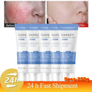 Facial Redness Repair Cream Sensitive Skin Dryness Moisturizer Hydrating Sooth Serum Lotion  Removal Rosacea Skin Care Ointments