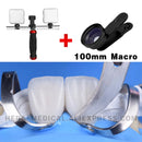 Dental Photography LED Light Bluetooth Intraoral Photo Lighting For Dentist Treatment Lamp Equipment For Dentist. MK-004