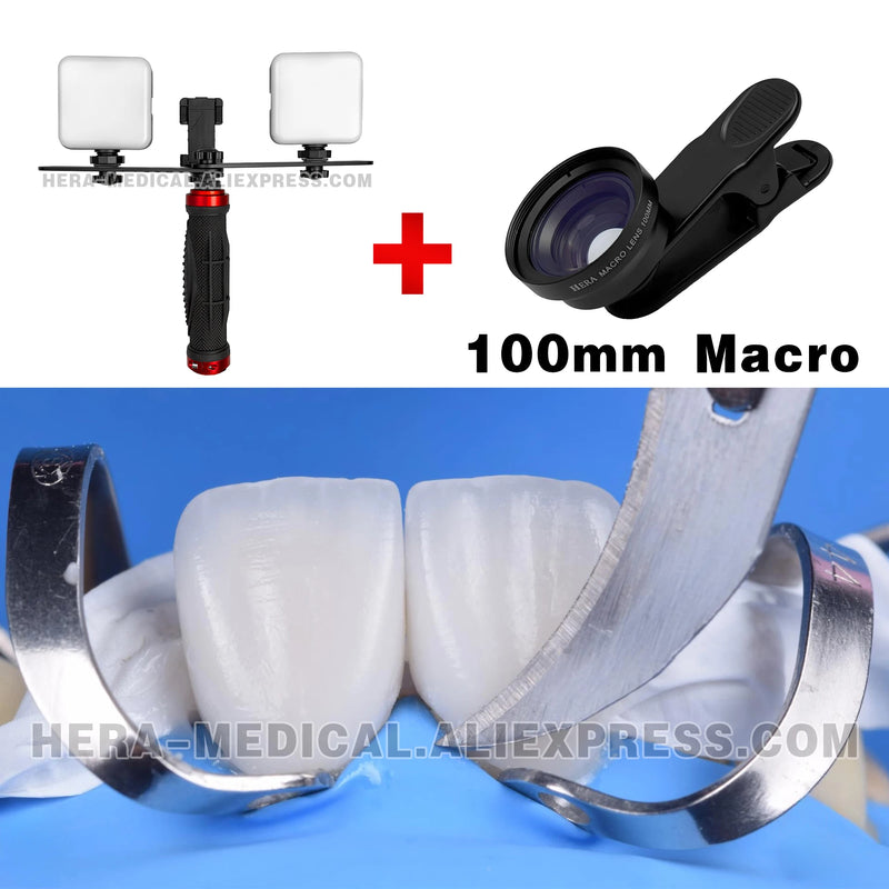 Dental Photography LED Light Bluetooth Intraoral Photo Lighting For Dentist Treatment Lamp Equipment For Dentist. MK-004