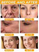 Hyaluronic Acid Instant Wrinkle Remover Essence Fade Fine Lines Face Serum Anti Aging Firming Lifting Whitening Korean Skin Care