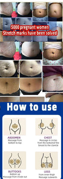 Stretch Marks Treatment Repair Essential Oil Skin Care Cream For Maternity Remover Anti-Wrinkle Slackline For Pregnant Body Oils