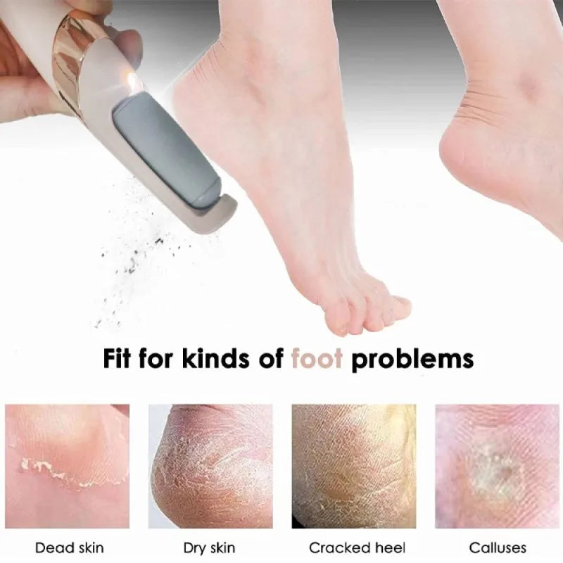 Rechargeable Electric Foot File Callus Remover Pedicure Machine Apparatus for Heels Grinding Device Foot Corns Remove Roller