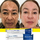 Effective Whitening Freckles Cream Remove Melasma Dark Spots Fade Pigmentation Moisturize Brighten Face Skin Care Product