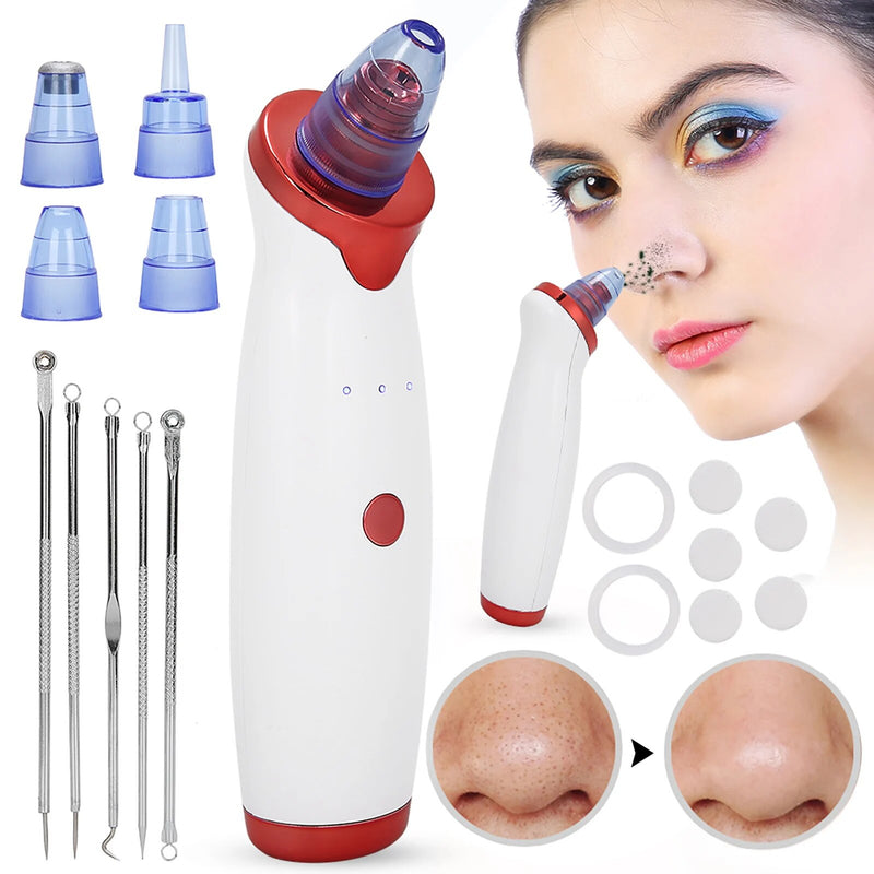 Facial Blackhead Remover Electric Acne Black Spots Pore Cleaner 3 Levels Adjustable Vacuum Suction Device with 4 Suction Heads