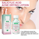 OUHOE Salicylic Acid Akne-Trocknungs-Lotion Salicylsäure Entfernt tief Akne Repariert feuchtigkeitsspendendes Gesichtsserum