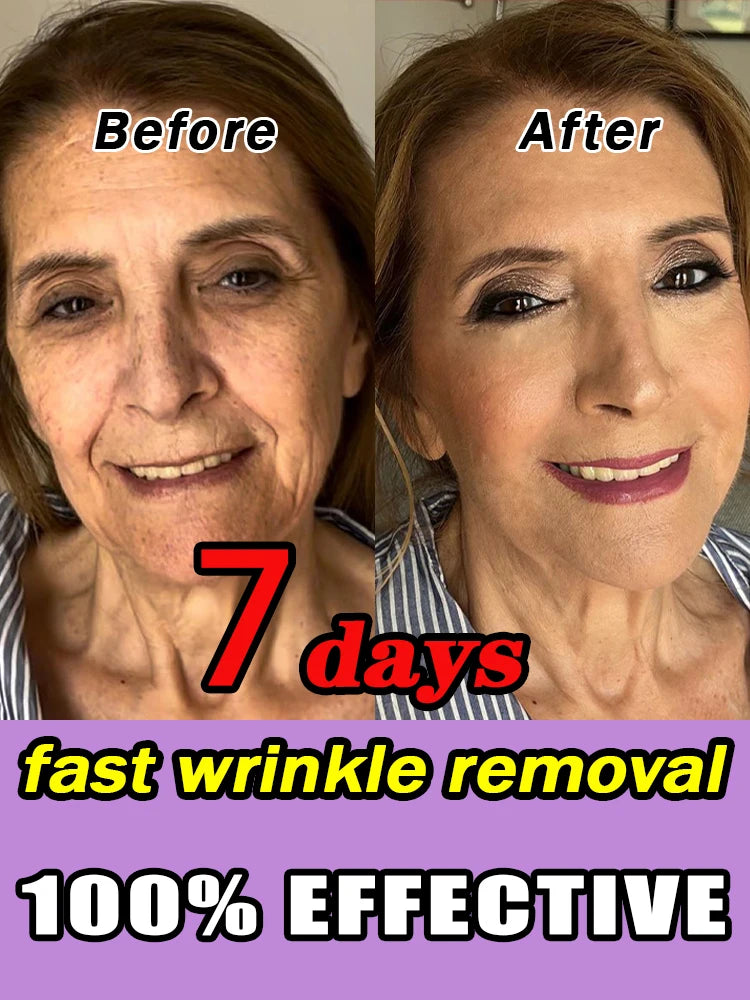 Make wrinkles disappear in one week