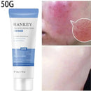 Facial Redness Repair Cream Sensitive Skin Dryness Moisturizer Hydrating Sooth Serum Lotion  Removal Rosacea Skin Care Ointments