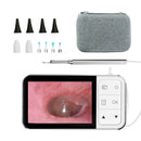 Ear Wax Removal Tool with HD Camera 4.3" Screen Digital Otoscope Ear Cleaning Kit with Soft Silicone Tips for Kids