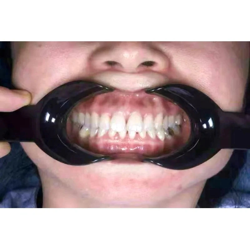 4Pcs Dental Orthodontic Mouth Opener T-Shape Cheek Lip Retractor Intraoral Opener Spreader Dentistry Materials