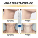 Collagen Neck Cream Anti-aging Tightens Lifts The Neck Chin Efficient Reducing Fine Lines In Skincare Brightening Moisturizing