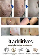 Stretch Marks Treatment Repair Essential Oil Skin Care Cream For Maternity Remover Anti-Wrinkle Slackline For Pregnant Body Oils
