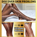 Ultimate Whitening Skin Care Set, With Retinol, Collagen, Remove Dark Spot, Moisturize, Nourish, Lighten Skin For All Skin Types