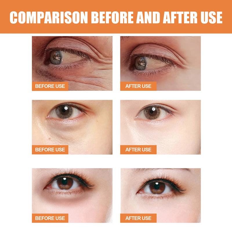 Vitamin C Eye Cream Stick Anti-Wrinkle Moisturizing Balm Eye Bag Removal Dark Circles Reduce Fine Lines Anti Puffiness Eye Cream