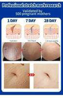 Stretch Marks Treatment Repair Essential Oil Skin Care Cream For Maternity Remover Anti-Wrinkle Slackline For Pregnant Body Oils