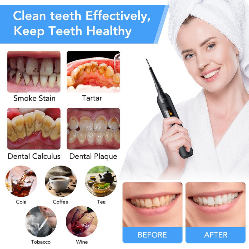 Elektrischer Sonic Dental Scaler zum Aufhellen von Zähnen Zahnsteinreiniger Zahnsteinentferner Tool Kit