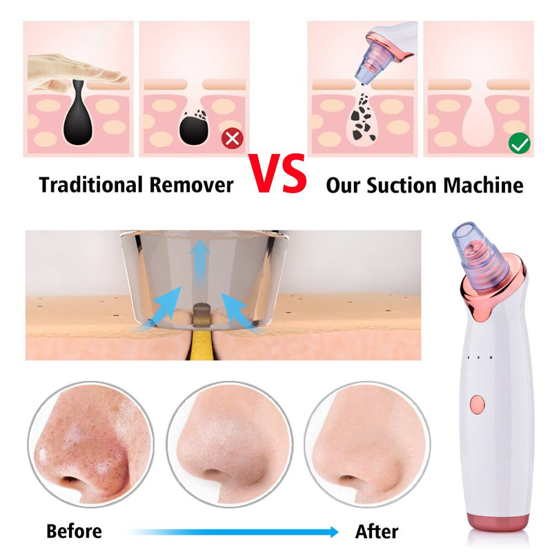 Blackhead Remover Vacuum Electric Nose Beauty Face Deep Cleansing Skin Care Vacuum Black Spots Acne Pore Cleaner Pimple Tool