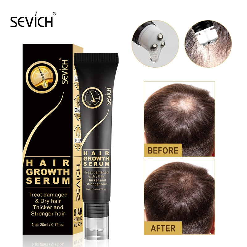 Sevich Hair Growth Oil Ginger Extract Growing Serum Prevent Hair Loss Care Scalp Massage Roller Treatment Thickener Essence 20ml