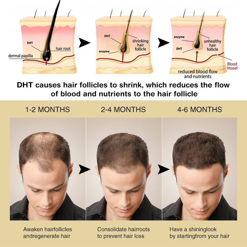 PURC Hair Growth Shampoo Prevent Hair Loss Scalp Treatment Enhance Hair Regrowth Conditioner Hair Care Products Sets for Women