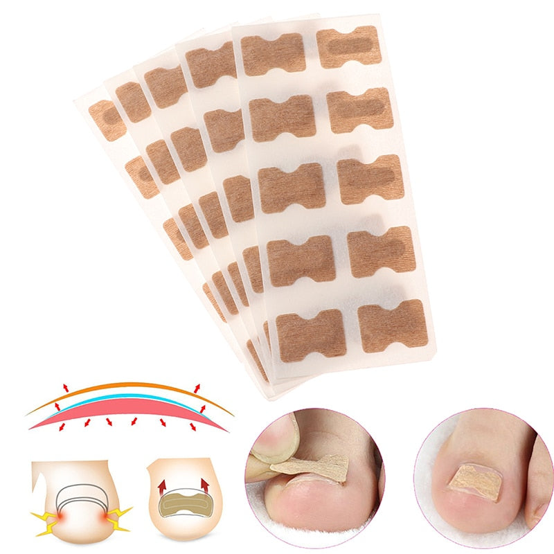 5Pcs Nail Art Ingrown Correction Sticker Fixer Paronychia Recover Toenail Elastic Patch Corrector Foot Care Pedicure Tool