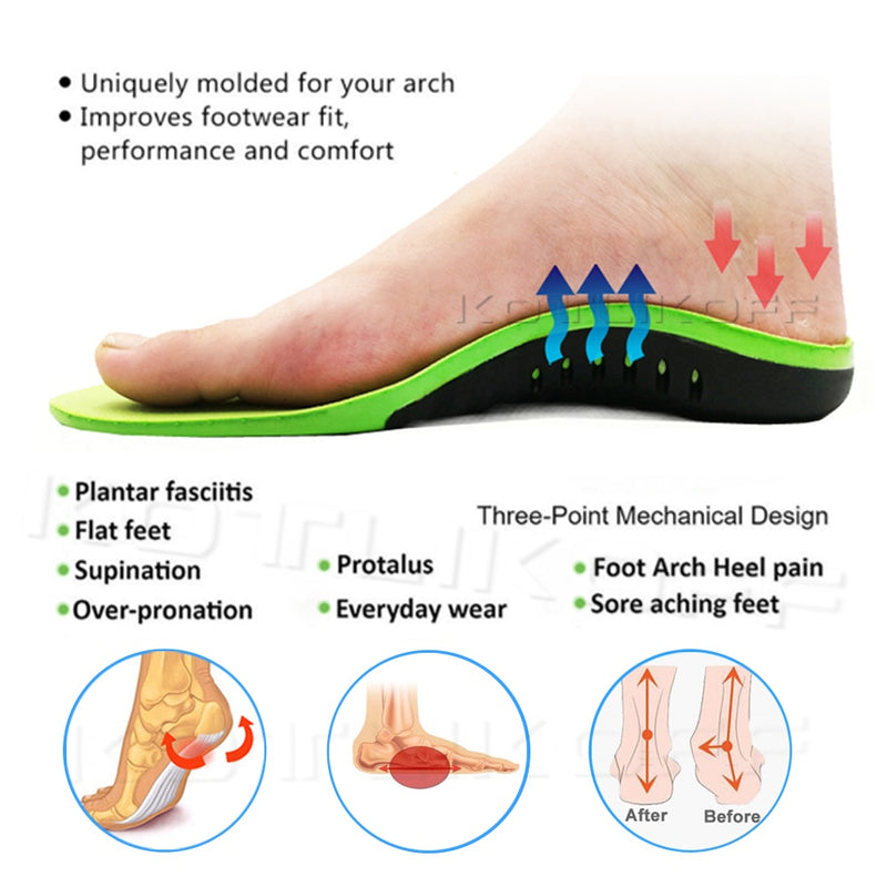 Best Orthopedic Shoes Sole Insoles For Shoes Arch Foot Pad X/O Type Leg Correction Flat Foot Arch Support Sports Shoes Inserts