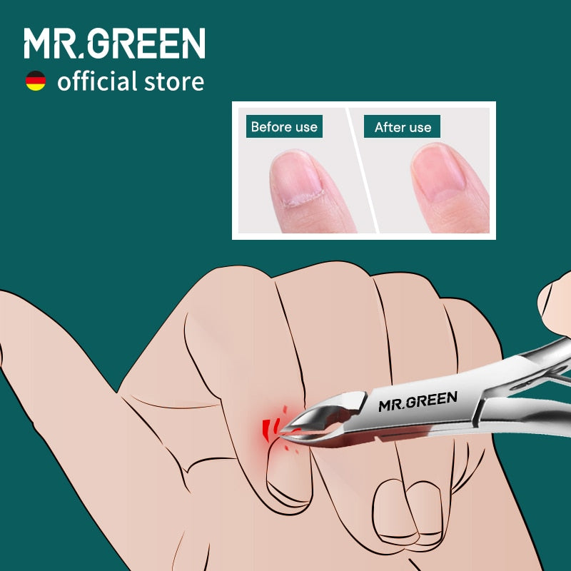 MR.GREEN Nagelhautzange Nagelmaniküre Nagelhautschere Clippers Trimmer Abgestorbene Hautentferner Pediküre Edelstahlschneider Werkzeug