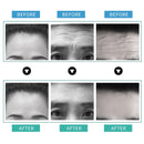 Parche Ilisya para surcos en la frente, pegatinas antiarrugas para eliminar líneas, hidrogeles para líneas de expresión, parche hidratante antienvejecimiento para el cuidado de la piel