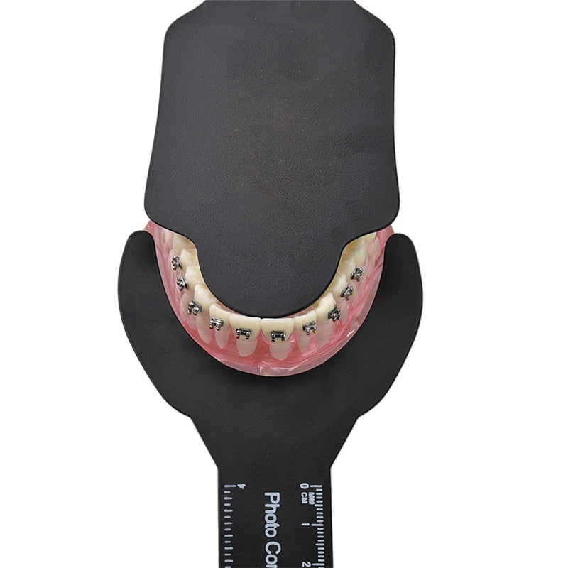 Tablero de fondo negro de ortodoncia Dental, tablero de contraste de imagen de foto, placa de mejilla Oral con marca de escala, herramientas esterilizables en autoclave, 6 uds.