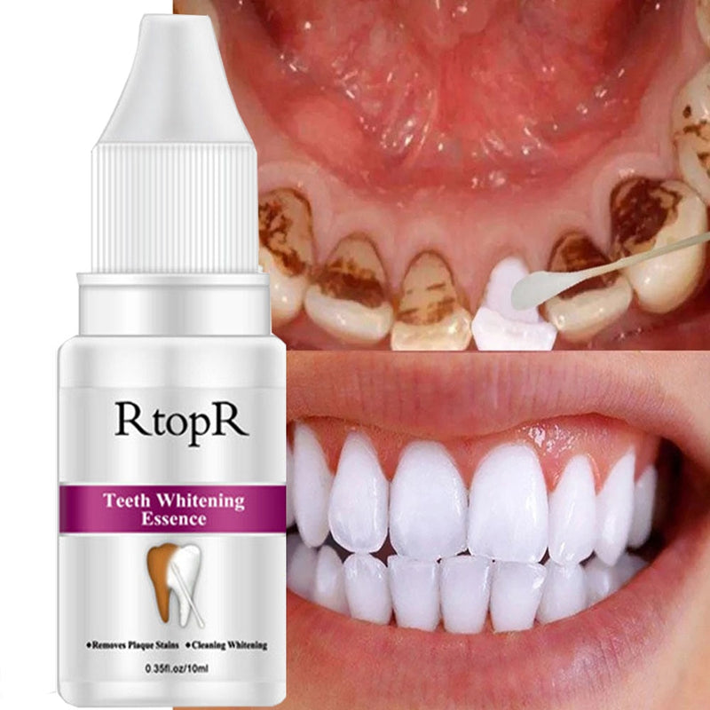 Teeth Whitening Essence Flecken Gelbe Zähne Behandlung Smoke Coffee Plaque Dental Mundhygiene Whitening Zahnpflege entfernen
