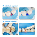 AZDENT Dental Sectional Matrix Contoured System Metal Matrices Dentistry Matrix Band Resin Clamping Seperating Ring Autoclavable