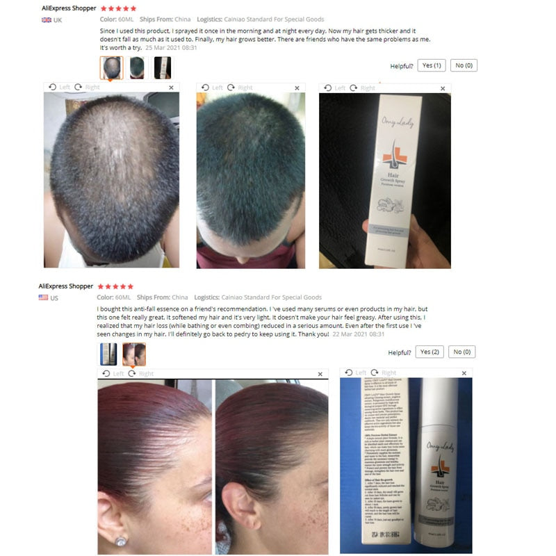 Spray para el crecimiento del cabello OMY LADY, antipérdida de cabello, esencial para el crecimiento rápido, previene el cabello dañado, adelgazamiento, reparación, tratamiento del cuero cabelludo, 60ml