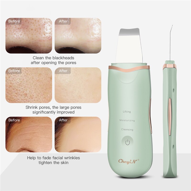 Ckeyin Ultrasonic Deep Face Cleaning Machine Skin Scrubber Remove Dirt Blackhead Reduce Wrinkles spots Facial Whitening Lifting