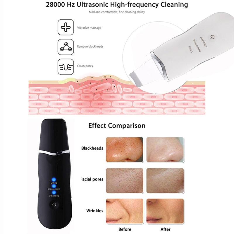 Ultrasonic Scrubber Deep Cleansing Face Scrubber Facial Cleansing Shovel Exfoliating Skin Scraper Peeling Beauty Instrument