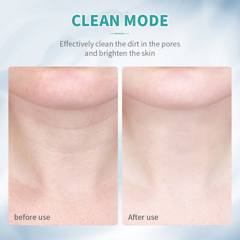 ANLAN Neck Face Beauty Device 3 Farben LED Photonentherapie Hautstraffung Reduzieren Doppelkinn Anti-Falten entfernen Hautpflege-Tools