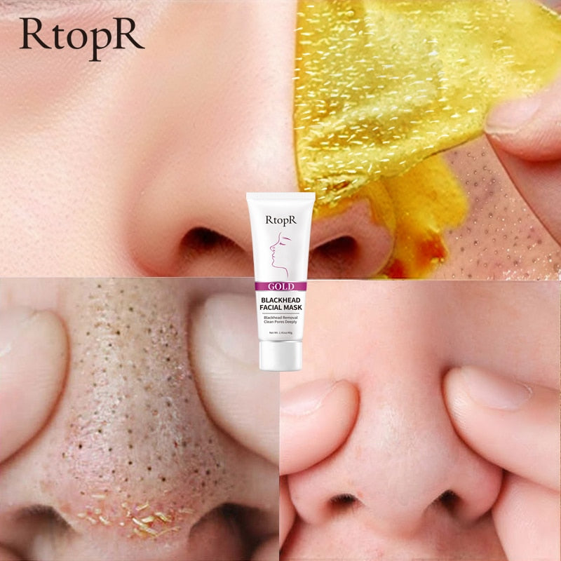 RtopR New Gold Remove Blackhead Gel Facial Pore Peeling Acne Treatment Nose Deep Cleansing Face Whitening Hydrating  Golden mud