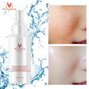 Shea Butter Collagen Hyaluronic Acid Extract Moisturizing Face Toners Skin Care Moisturizing Whitening Acne Treatment Face Care