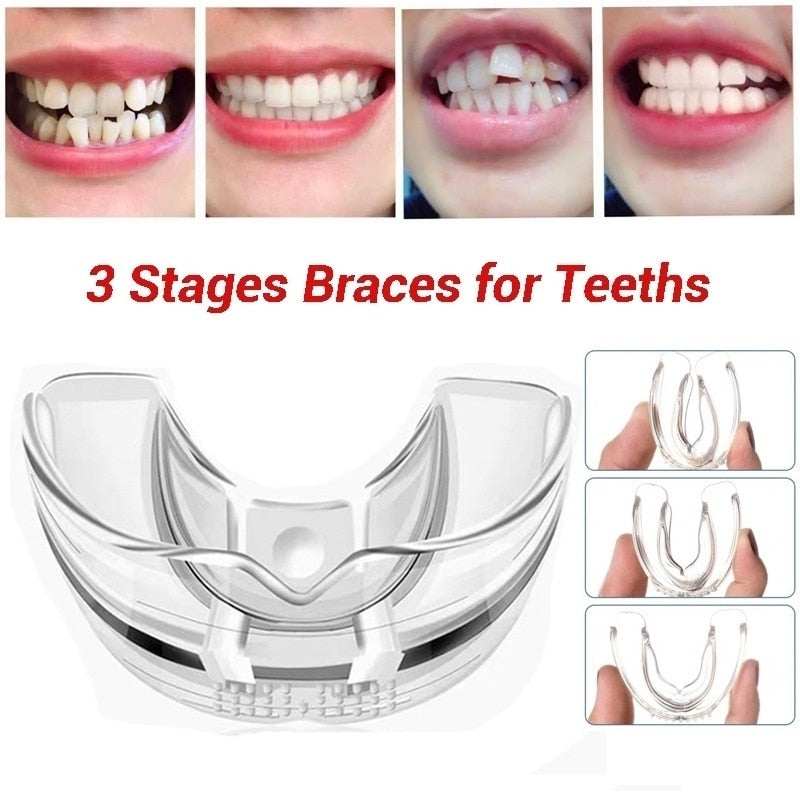 3 Stufen Kieferorthopädische Zahnspangen Gerät Zahnspangen Ausrichtungstrainer Zähne Retainer Bruxismus Mundschutz Zahnglätter
