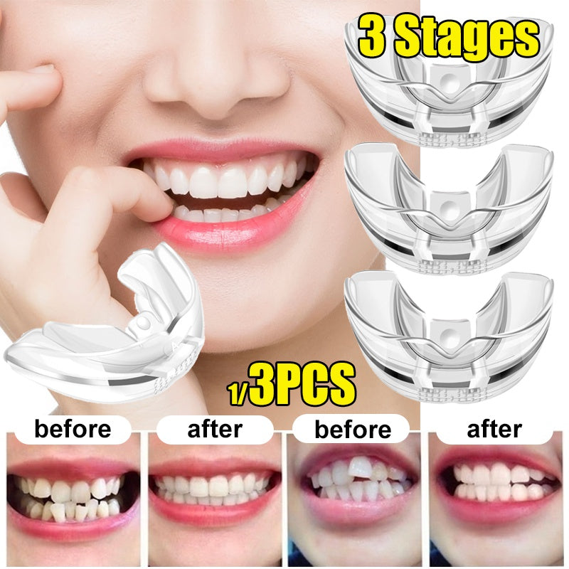 3 teile/satz Zahn Kieferorthopädische Trainer Dental Zahn Gerät Ausrichtung Brace Silikon Material Professionelle Wache TeethStraightener