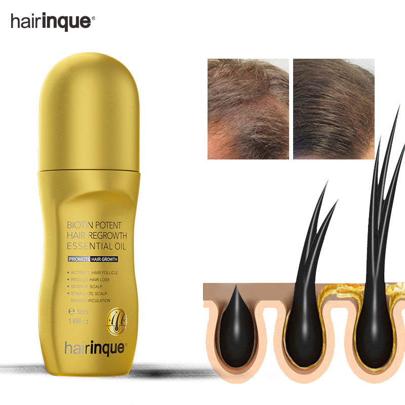 Hairinque, 50ml, vitamina B7, productos para el crecimiento rápido del cabello, suero para prevenir la pérdida de cabello, tratamientos para el cuero cabelludo, aceite para el cuidado del cabello en crecimiento para hombres y mujeres